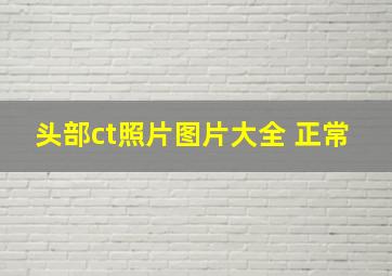 头部ct照片图片大全 正常